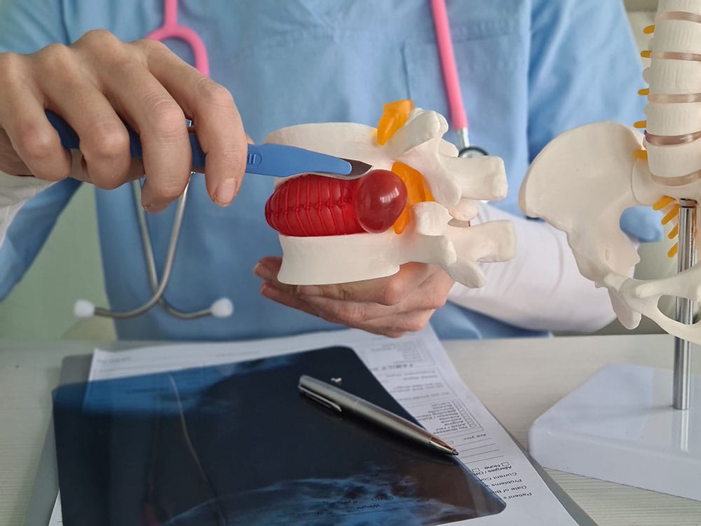 AdobeStock_359241663_Preview Intervertebral hernia and surgery concept